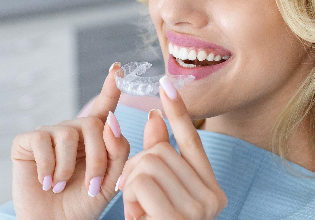invisalign